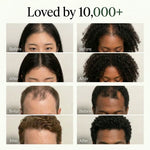 Grid of multiple customer before and after hair growth results loved by ten thousand plus users
